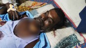 স্বামীর গলা ও গোপনাঙ্গ কেটে হত্যাচেষ্টার অভিযোগ, স্ত্রী আটক