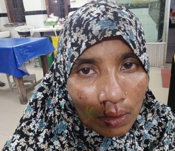 সাতক্ষীরায় গৃহবধূকে পিটিয়ে জখম