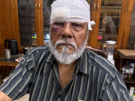 মাগুরায় সাবেক সচিব আক্রান্ত