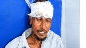 লোহাগড়ায় বড় ভাই-ভাবির পিটুনিতে ছোট ভাই হাসপাতালে