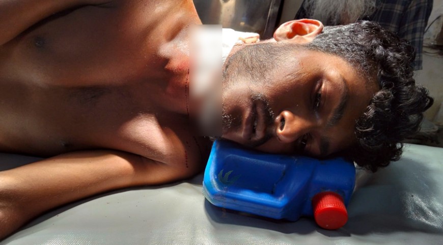 যশোরে বড় ভাইয়ের বটির কোপে ছোটজন জখম