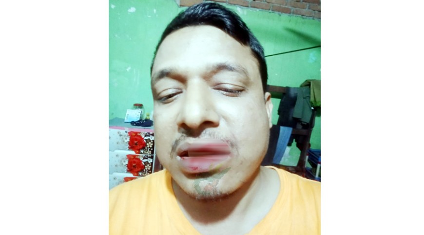 লোহাগড়ায় বড় ভাইয়ের হাতে ছোটজন জখম