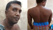 বিএসএফের গুলিতে আহত সাতক্ষীরার বৈষ্ণব যশোরে চিকিৎসাধীন
