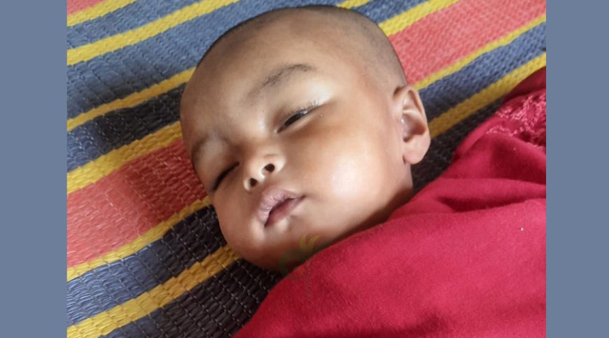 হামের লক্ষণ নিয়ে ঝিনাইদহে শিশুর মৃত্যু