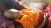 ভাইয়ের কোলে শুয়ে মামলা করতে এলেন মাথার খুলি ভেঙে যাওয়া নাছিমা