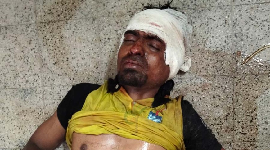 যশোরে সহকর্মীর হাতে হোটেল কর্মচারী জখম