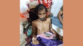 যশোরে বজ্রপাতে দুই কৃষক হতাহত