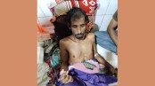 যশোরে বজ্রপাতে দুই কৃষক হতাহত