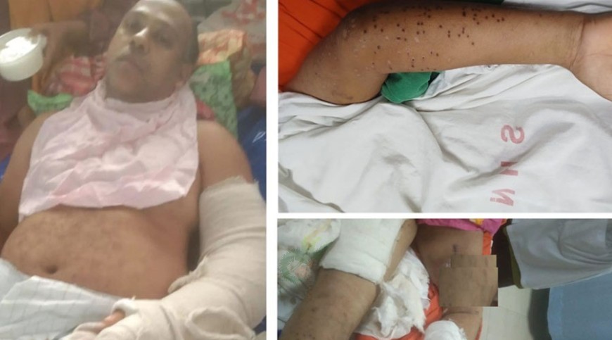 জুলাইযোদ্ধা আমিনুল: ‘মৃত ভেবে ফেলে রাখা হয়েছিল আমাকে’