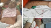 জুলাইযোদ্ধা আমিনুল: ‘মৃত ভেবে ফেলে রাখা হয়েছিল আমাকে’
