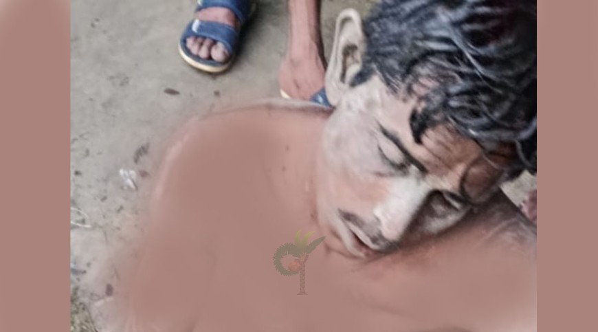 চোর সন্দেহে মারপিটে একজন আহত