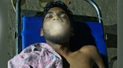 চিকিৎসাধীন অবস্থায় তরুণের মৃত্যু
